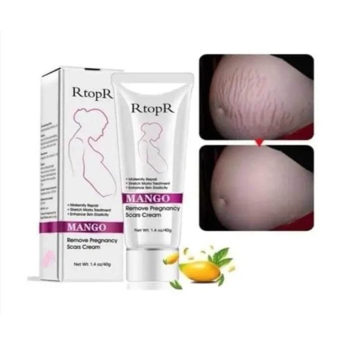 RtopR Mango Stretch Marks and Scar Cream -Stretch Marks and Scar Removal Cream for Pregnancy - Best Body Moisturizer-40g | Products | B Bazar | A Big Online Market Place and Reseller Platform in Bangladesh