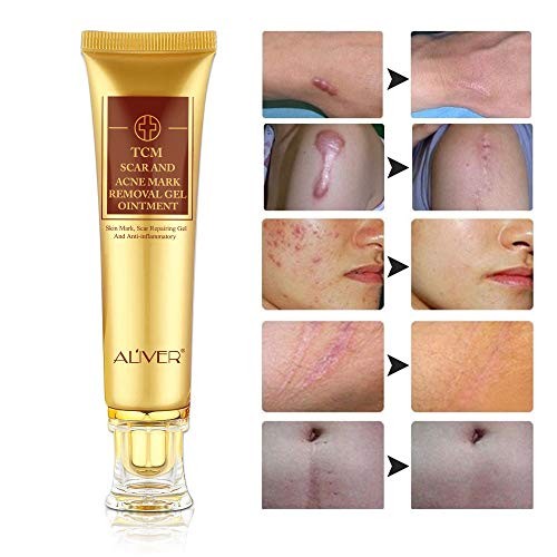 TCM Scar and Acne Removal