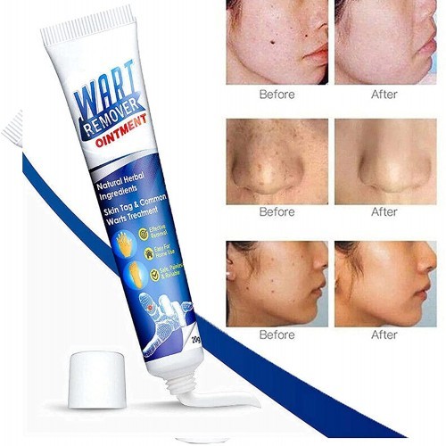 Wart Remover Ointment best product | Products | B Bazar | A Big Online Market Place and Reseller Platform in Bangladesh