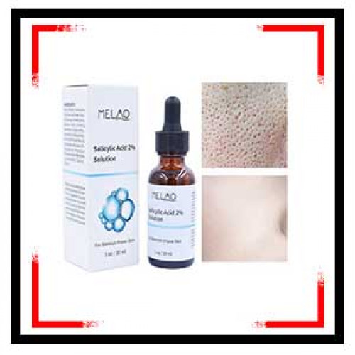 Melao Salicylic Acid 2 Solution