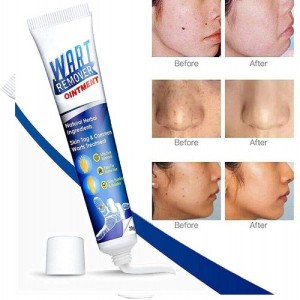 Wart Remover Ointment best product